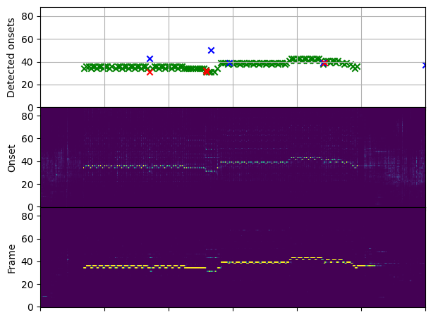 Erkannte Onsets bei Verwendung eines ML-Modells